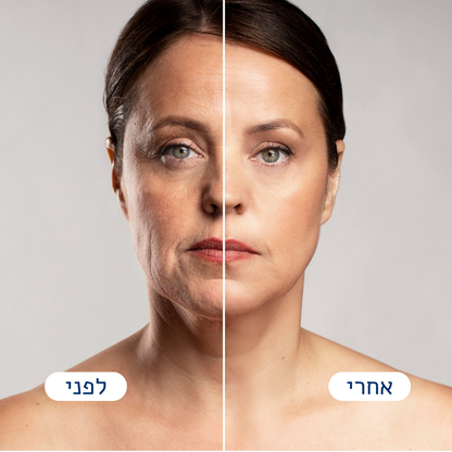 Frova™ - הפטנט לעיצוב הפנים וקו הלסת